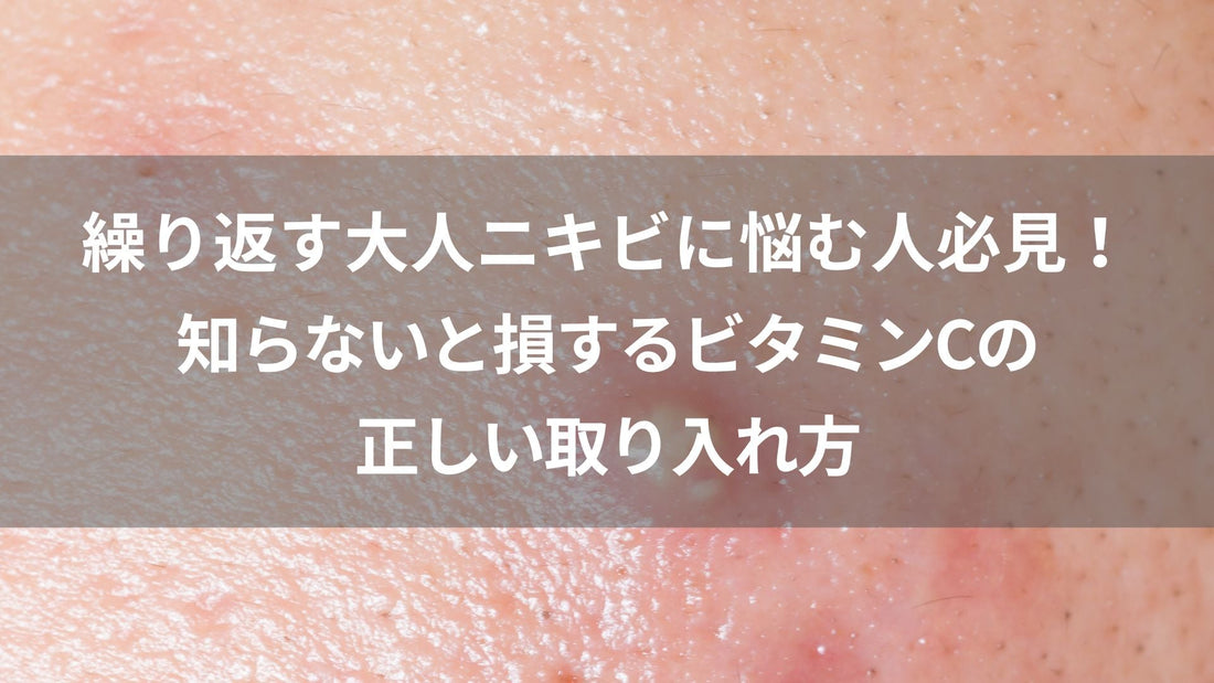繰り返す大人ニキビに悩む人必見！知らないと損するビタミンCでの対策の秘訣